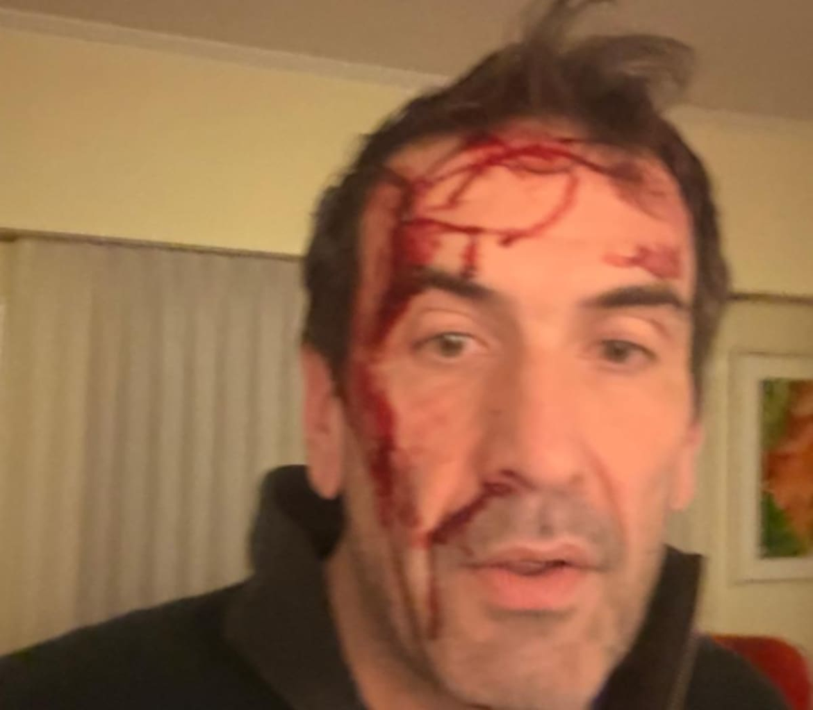 Un candidato a senador de LLA denunció que sufrió una Un candidato a senador de LLA denunció que sufrió una entradera y fue golpeado